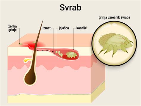 Povečan prikaz zdrave kože