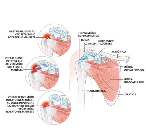 Diagram prikazuje rotacijo manšete turnega pancarja