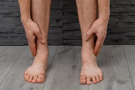 prikaz erizipela na nogi