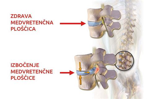 Diagram človeške hrbtenice z označenim vratnim delom